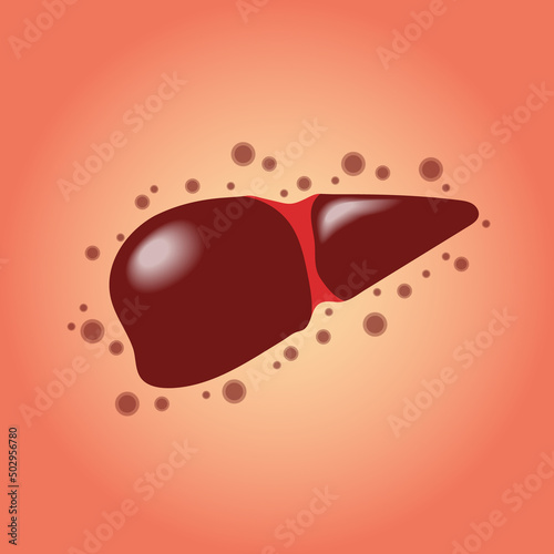 Vector illustration of Human Heart infected with Adenovirus A Mysterious Hepatitis Case that attacks children. Suitable for editorials of current disease cases in the world.