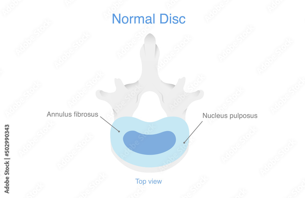 Human Lumbar Spine Anatomy. Illustration about Illustration of Medical diagram about the spine for check disc herniation and other problems. Human Lumbar Spine Anatomy. Illustration about Illustration of Medical diagram about the spine for check disc herniation and other problems.