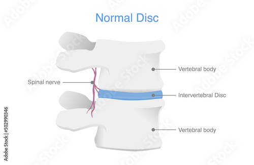 Anatomy of normal human Disc. Illustration of Medical diagram about the spine in top view for check disc herniation. nucleus pulposus, annulus fibrosis.