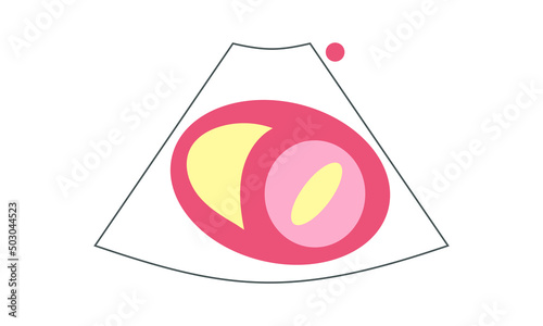 Diagram of Parasternal Short Axis View at Mitral Valve of Echocardiography. Healthcare Concept