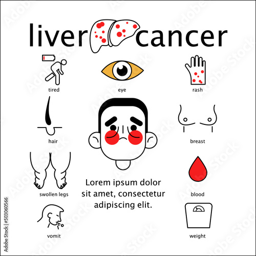 Infographics of sign and symptoms of liver disease