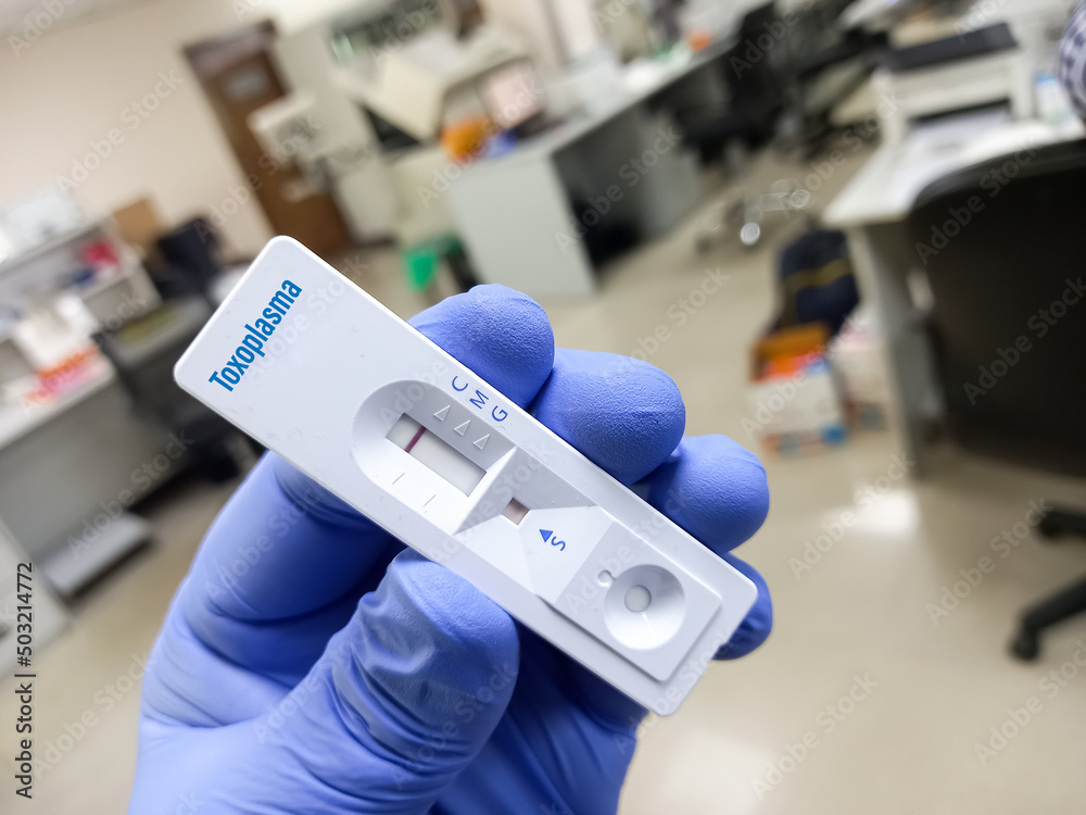 Rapid test kit for Toxoplasma test, show positive result, rapid test cassette.