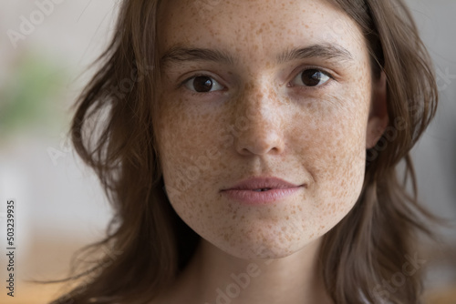 Serious freckled girl facial close up portrait. Pretty beautiful young woman clean face without makeup, with fresh spotted skin looking at camera. Natural beauty, skincare, cosmetology concept