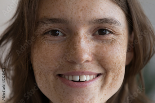 Face of happy freckled girl looking at camera with toothy smile. Pretty young woman with spotted facial skin, fresh complexion close up front portrait. Natural beauty, skincare, cosmetology concept