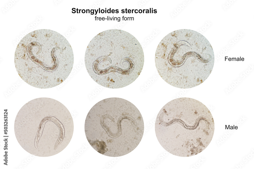 Poster Microscopic view collage of free-living form male and female ...