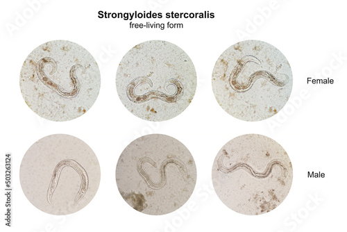 Microscopic view collage of free-living form male and female Strongyloides stercoralis in human stool, a pathogenic parasitic threadworm causing the disease strongyloidiasis. photo