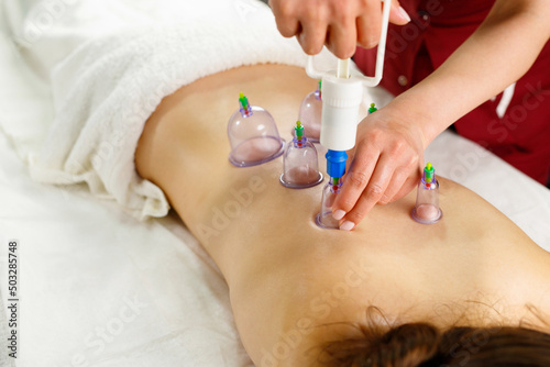 Close-up of young woman lying with banks on her back in spa salon  vacuum banks in treatment and cosmetology.