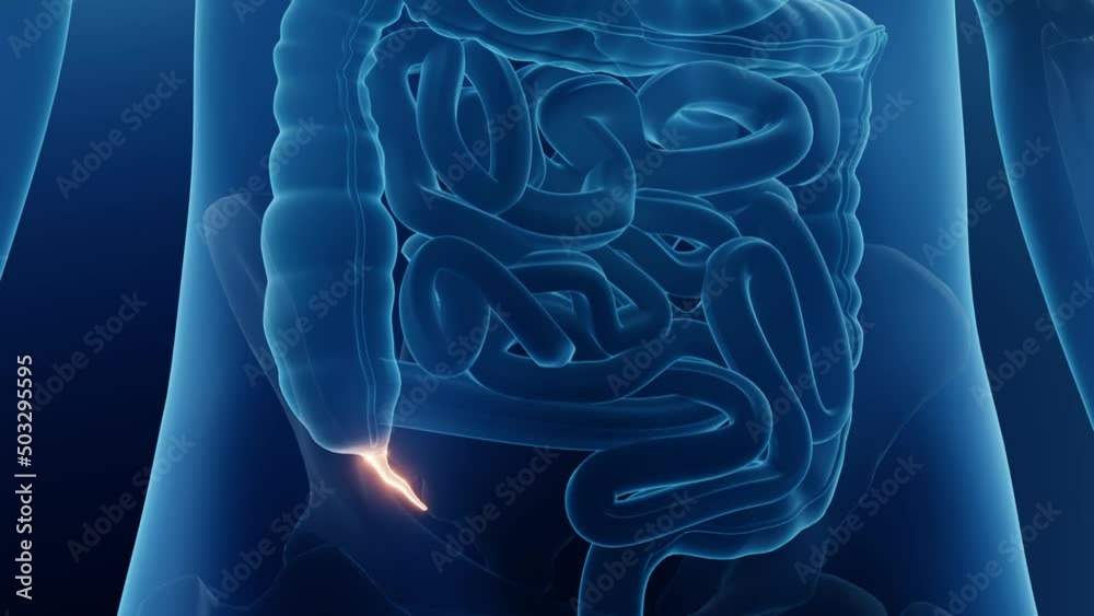 Appendix in human body close up, Appendicitis conceptual animation