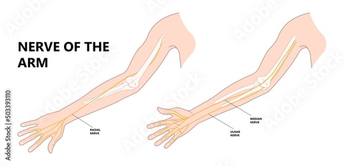Pronator teres syndrome of nerve palsy carpal tunnel claw hand sport injury pain arm elbow joint ulnar wrist drop distal outlet neuropathies fall Radial motor tendon night Phalen test preacher papal