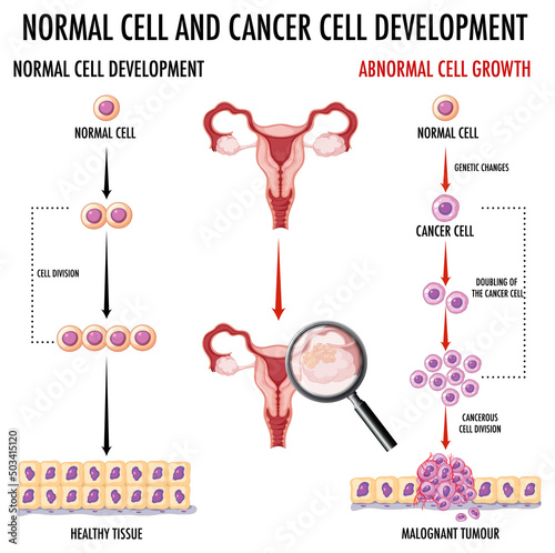 Diagram showing normal and cancer cells in human