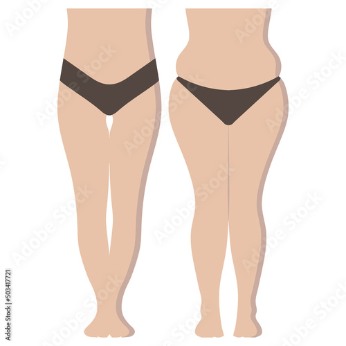 Thin and fat. Vector illustration of a fat and thin female belly. Fat girl and skinny girl. Weight set. Slimming. Diet. Sport.