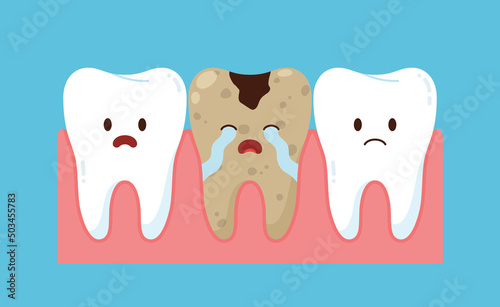 Cute tooth with dental plaque and healthy ones set, flat vector isolated.