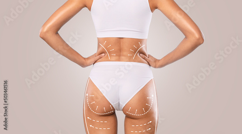 Slimming. Rear Back View Of Lady Posing With Drawn Arrows