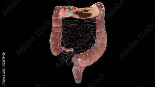 Fotografia 3d illustration of human digestive system anatomy, concept of the intestine,  la