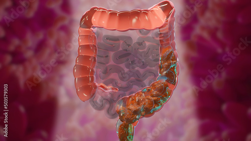 Foto 3d illustration of human digestive system anatomy, concept of the intestine,  la