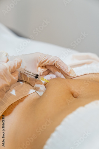 Mesotherapy treatment. Beautician applying an injection in the belly of a woman for fat reduction.