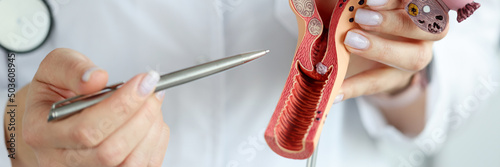 Doctor gynecologist showing pen on plastic model of uterus and ovaries closeup photo