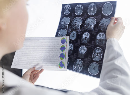 Papier peint Epileptologist examines patient MRI and electroencephalogram