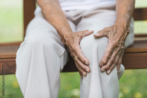 Senior woman holding her painful knee © and.one