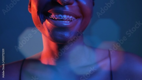 Happy smile. Orthodontic care. Dental correction. Neon blue red color closeup of woman mouth laughing with teeth braces in bokeh light isolated on dark.