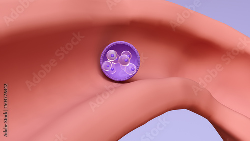 Travel of the embryo to newborn, 
Fertilization, Embryo Development, the blastocyst implantation and Fetal Development.