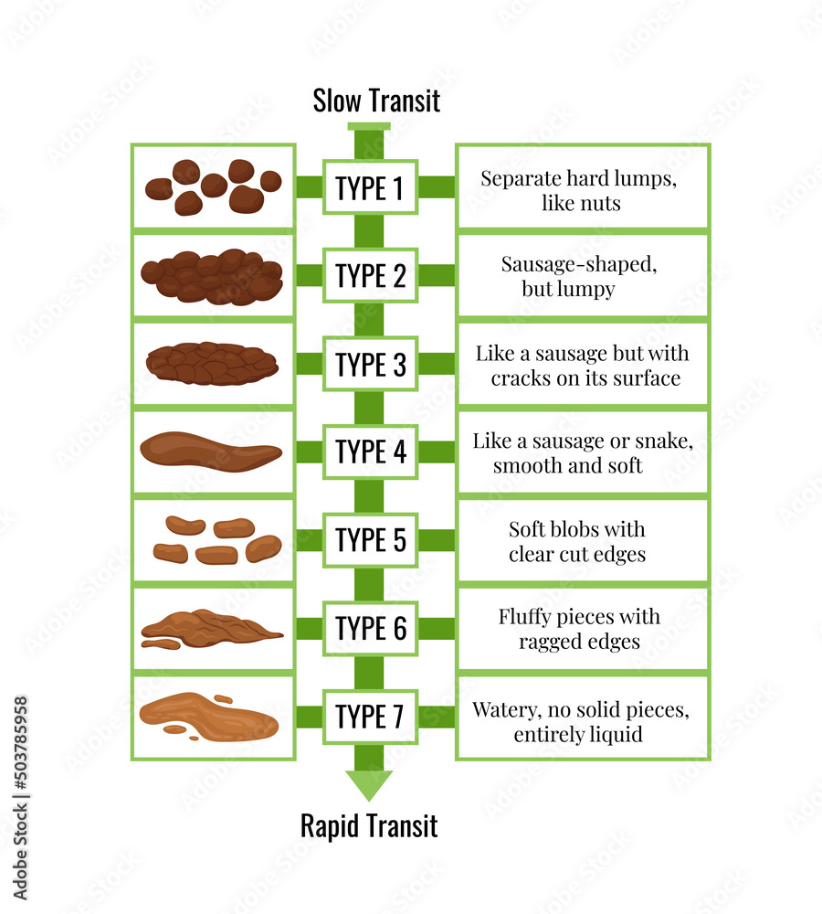 Bristol stool chart with faesces form classification, slow and rapid ...