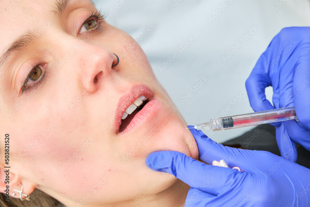 botulinum toxin mesotherapy on the chin botulinum toxin mesotherapy on the chin