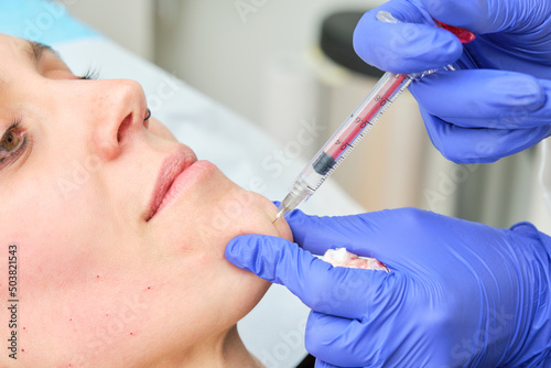 botulinum toxin injection in the chin