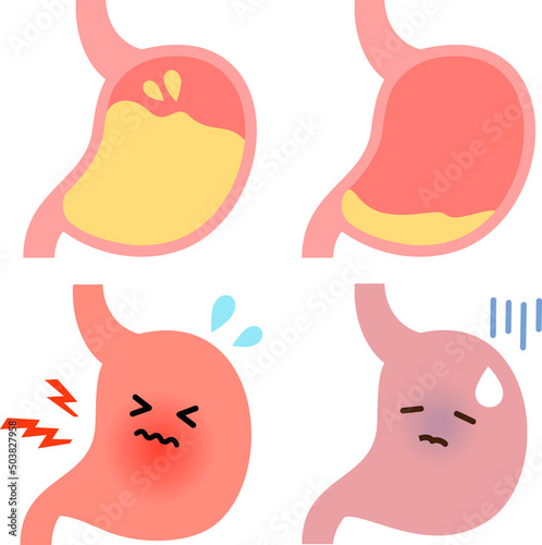 胃酸過多の胃と低胃酸の胃のキャラクター photo