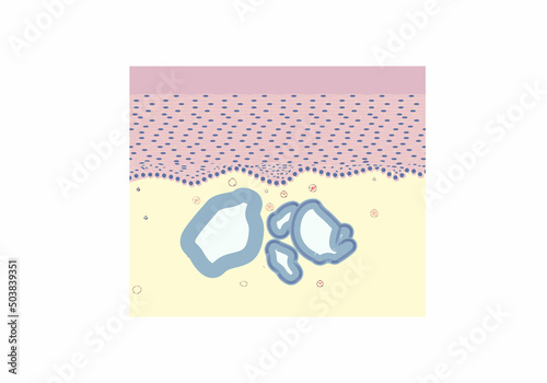 morphology of endocervicosis under a microscope, illustration, vector