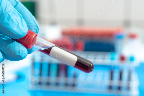 Test tube with empty label  to biological sample for medical laboratory research   on lab props background