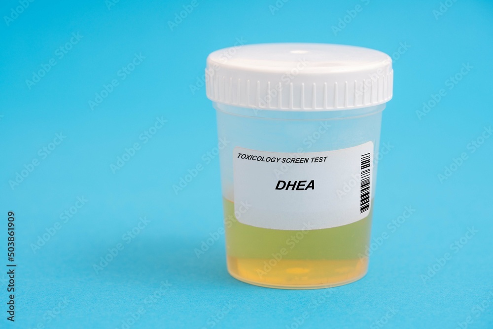 DHEA. DHEA toxicology screen urine tests for doping and drugs DHEA. DHEA toxicology screen urine tests for doping and drugs