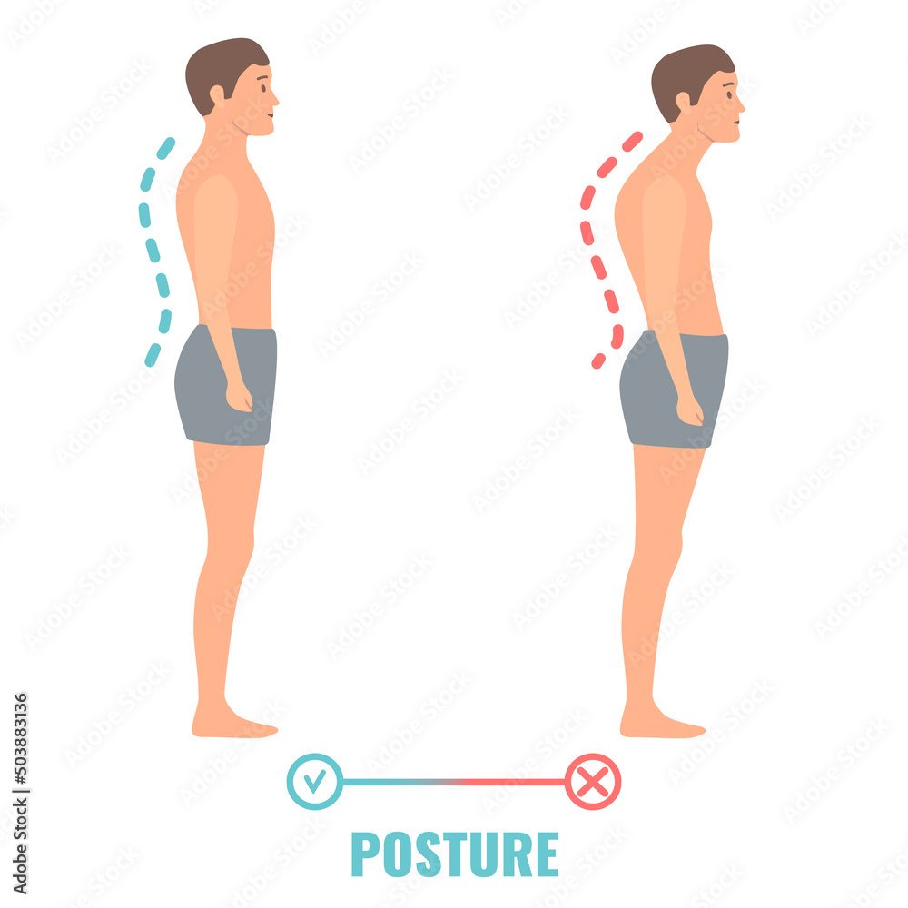 Good and bad posture on male body silhouette. Spine curvature with proper and poor stance. Right and wrong pose comparison. Medical vector illustration. - obrazy, fototapety, plakaty 