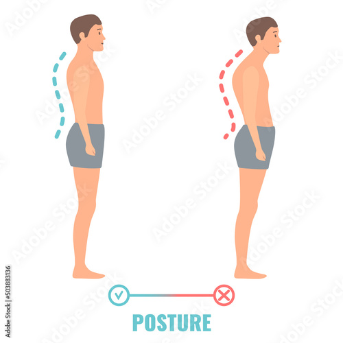 Good and bad posture on male body silhouette. Spine curvature with proper and poor stance. Right and wrong pose comparison. Medical vector illustration.
