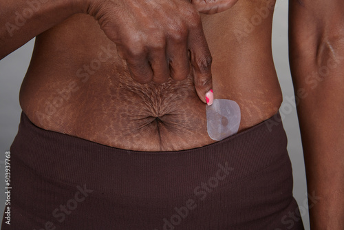 Belly of mature woman with HRT Patch photo