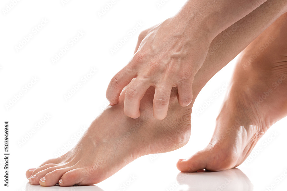 Female legs with dry itchy skin against white background Female legs with dry itchy skin against white background