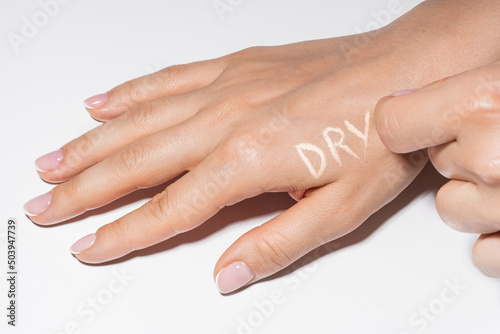 Female hands with itchy skin and DRY lettering on it