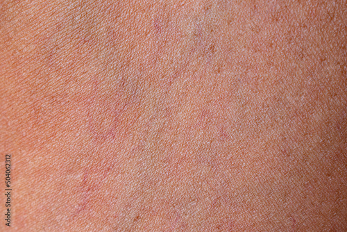 Close-up abstract close-up abstract pink tan human skin texture