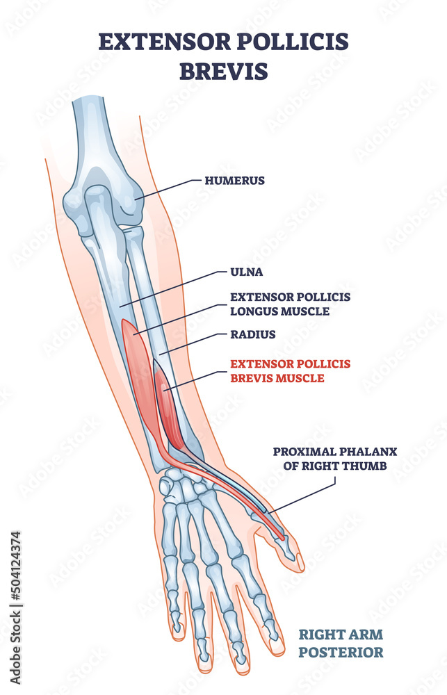 Extensor pollicis brevis muscle location with arm skeleton outline diagram. Labeled educational scheme with human hand bones description vector illustration. Physiological muscular system with palm. - obrazy, fototapety, plakaty 