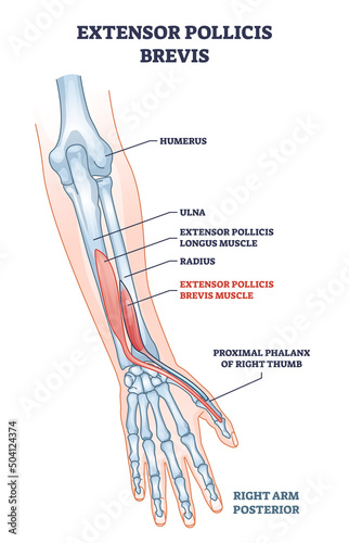 Extensor pollicis brevis muscle location with arm skeleton outline diagram. Labeled educational scheme with human hand bones description vector illustration. Physiological muscular system with palm.
