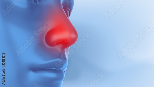 Clearing cold with decongestant nasal spray	