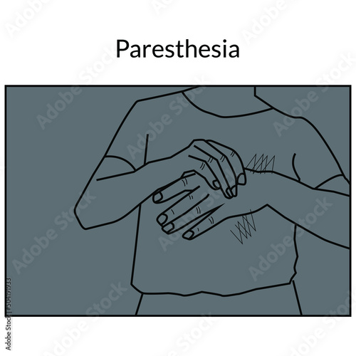 Paresthesia line art stock illustration. The vector image relates to a burning or tingling sensation in the hands 