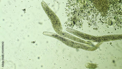Micro organism ciliates, microscope magnification 20X photo