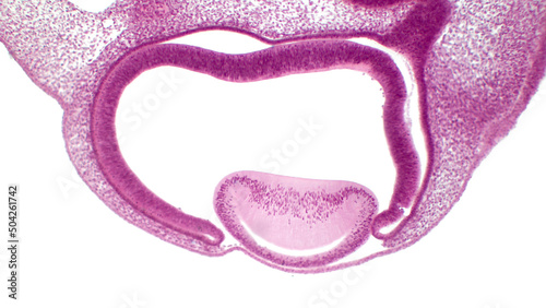 Eye development. Cells from both the mesodermal and the ectodermal tissues contribute to the formation of the eye.  In the center is a crystalline lens. photo