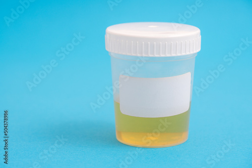 container with a urine sample for laboratory analysis photo