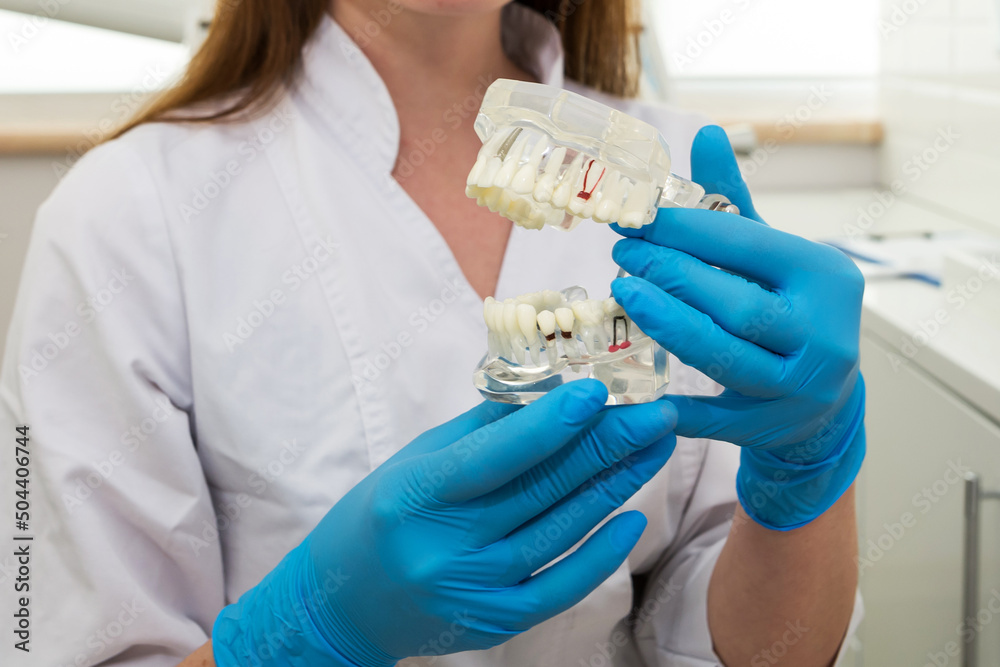 The doctor's hands in blue gloves hold an artificial jaw model close-up.