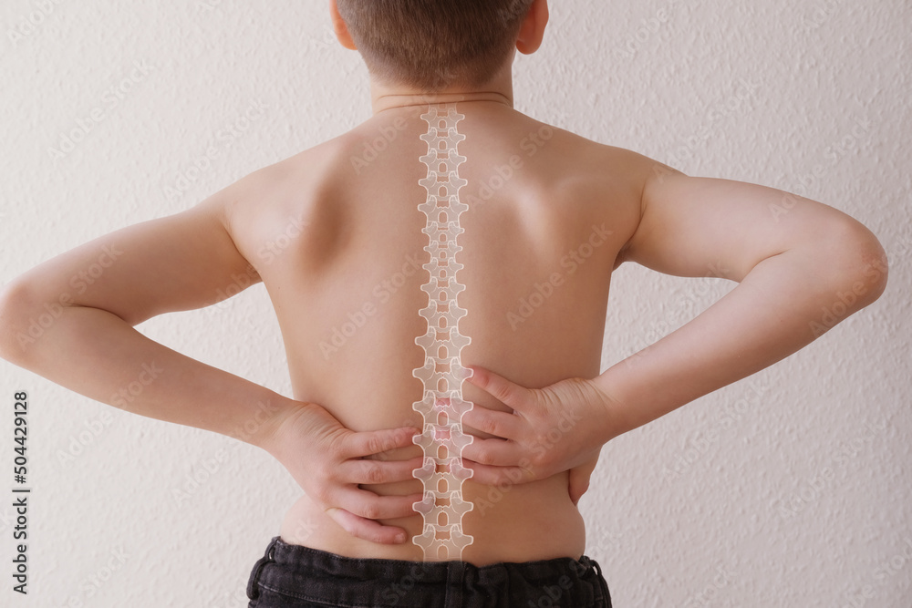 naked back of boy, child 8-10 years old grabbed a sore spot, curved ...