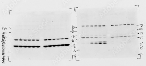 Принти на полотні Skan of western blotting film with an image of two membranes subjected to antibodies recognizing different protein species visible as black spots or blots