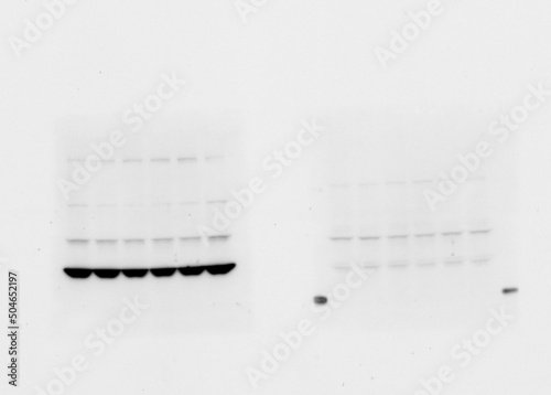Skan of western blotting film with an image of two membranes subjected to antibodies recognizing different protein species visible as black spots or blots.