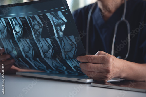 Doctor holding and looking patient bone x-ray film before surgery. MRI and CT scan examining at radiology orthopedic unit in hospital. Knee joint x-ray photo